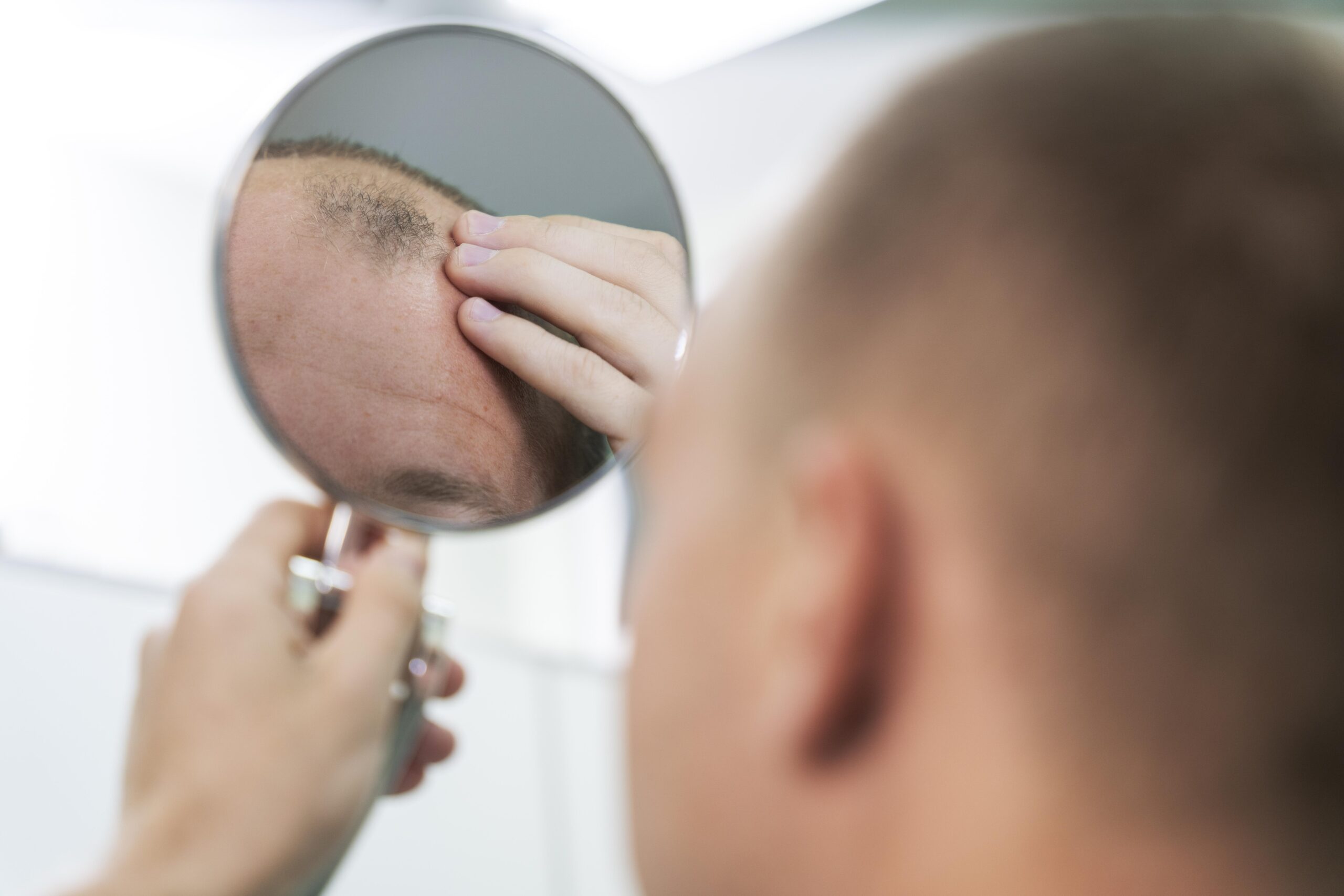 adult-male-having-balding-problems (1)